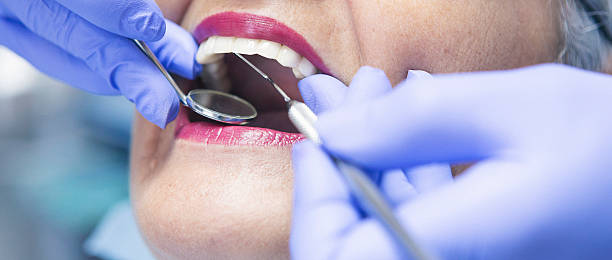 Best Urgent Care for Lost Fillings or Crowns in Oconomowoc, WI